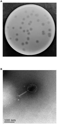 Isolation and characterization of novel bacteriophage vB_KpP_HS106 for Klebsiella pneumonia K2 and applications in foods
